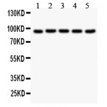 VIL1 / Villin Antibody - Villin antibody Western blot. All lanes: Anti Villin at 0.5 ug/ml. Lane 1: Rat Intestine Tissue Lysate at 50 ug. Lane 2: Mouse Kidney Tissue Lysate at 50 ug. Lane 3: RH35 Whole Cell Lysate at 40 ug. Lane 4: HEPG2 Whole Cell Lysate at 40 ug. Lane 5: MCF-7 Whole Cell Lysate at 40 ug. Predicted band size: 93 kD. Observed band size: 93 kD.