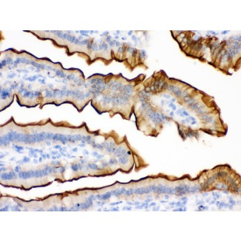 VIL1 / Villin Antibody - Villin antibody IHC-paraffin. IHC(P): Mouse Intestine Tissue.