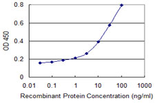 VIL1 / Villin Antibody - Detection limit for recombinant GST tagged VIL1 is 0.1 ng/ml as a capture antibody.