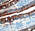 VIL1 / Villin Antibody - IHC of Villin on FFPE Colon tissue. This image was taken for the unmodified form of this product. Other forms have not been tested.