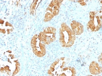 VIL1 / Villin Antibody - IHC testing of FFPE human rectum tissue with Villin antibody (clone VIL1/1314). Required HIER: boil tissue sections in 10mM citrate buffer, pH 6, for 10-20 min followed by cooling at RT for 20 min.