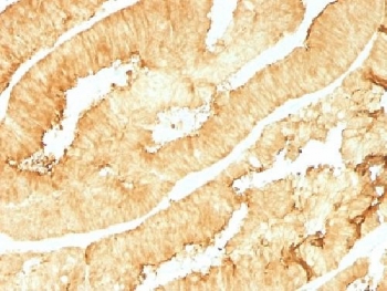 VIL1 / Villin Antibody - IHC testing of FFPE human colon with Villin antibody (clone VIL1/1314). Required HIER: boil tissue sections in 10mM citrate buffer, pH 6, for 10-20 min followed by cooling at RT for 20 min.