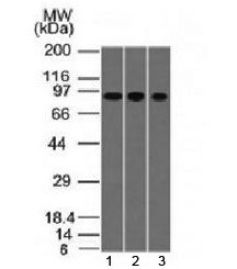 VIL1 / Villin Antibody - Western blot testing of human 1) A549, 2) HepG2 and 3) HCT-116 cell lysate with Villin antibody (clone VIL1/1314). Expected molecular weight ~93 kDa.