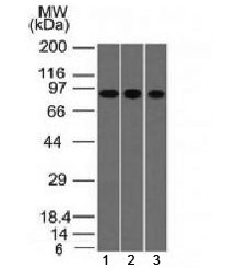 VIL1 / Villin Antibody - Western blot testing of human 1) A549, 2) HepG2 and 3) HCT-116 cell lysate with Villin antibody (clone VIL1/1325). Expected molecular weight ~93 kDa.