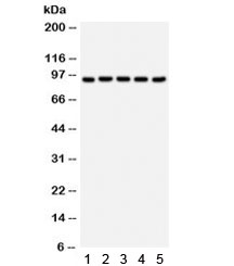 VIL1 / Villin Antibody