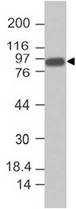 VIL1 / Villin Antibody - Fig-1: Western blot analysis of Villin. Anti-Villin antibody was tested at 0.5 µg/ml on A549, HepG2 and HCT116 lysates.