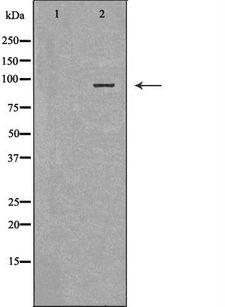 VIL1 / Villin Antibody - Western blot analysis of mouse liver tissue lysates using VIL1 antibody. The lane on the left is treated with the antigen-specific peptide.