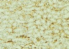 VIL1 / Villin Antibody - 1:100 staining mouse kidney tissue by IHC-P. The sample was formaldehyde fixed and a heat mediated antigen retrieval step in citrate buffer was performed. The sample was then blocked and incubated with the antibody for 1.5 hours at 22°C. An HRP conjugated goat anti-rabbit antibody was used as the secondary.