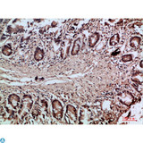 VIL1 / Villin Antibody - Immunohistochemical analysis of paraffin-embedded human-colon, antibody was diluted at 1:200.