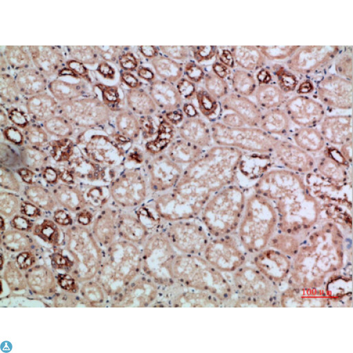 VIL1 / Villin Antibody - Immunohistochemical analysis of paraffin-embedded human-kidney, antibody was diluted at 1:200.