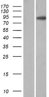 VIL1 / Villin Protein - Western validation with an anti-DDK antibody * L: Control HEK293 lysate R: Over-expression lysate