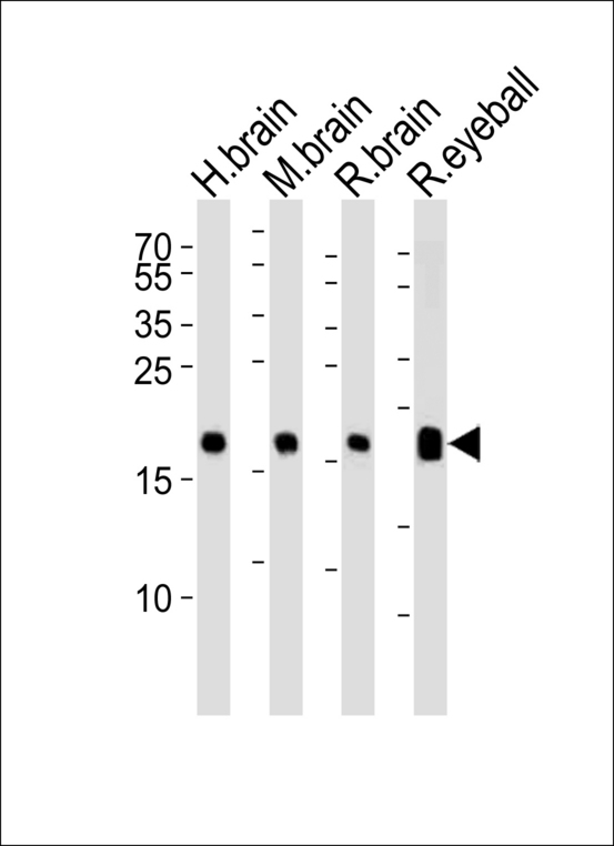 VILIP / VSNL1 Antibody - Western blot of lysates from human brain, mouse brain, rat brain and rat eyeball tissue lysate (from left to right), using VILIP1 Antibody. Antibody was diluted at 1:1000 at each lane. A goat anti-rabbit IgG H&L (HRP) at 1:5000 dilution was used as the secondary antibody. Lysates at 35ug per lane.
