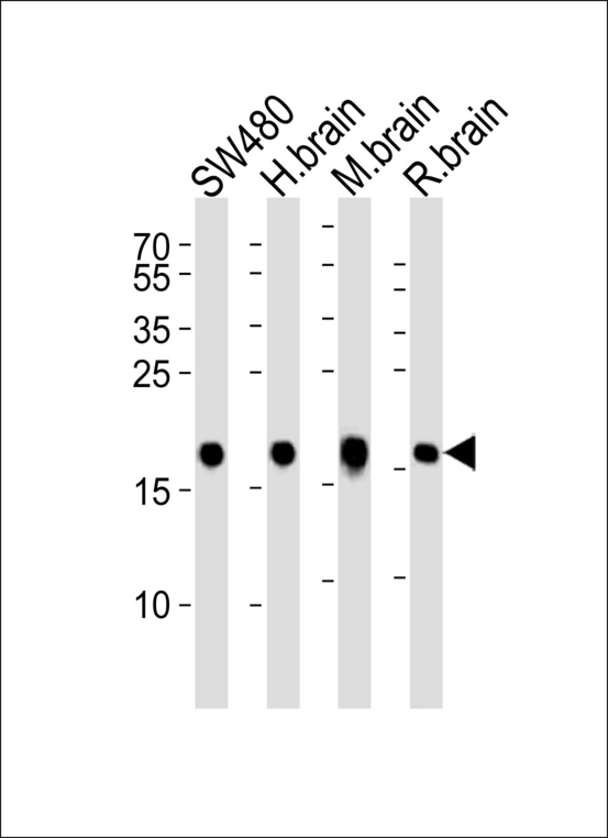 VILIP / VSNL1 Antibody - Western blot of lysates from SW480 cell line, human brain, mouse brain and rat brain tissue lysate(from left to right), using VILIP1 Antibody. Antibody was diluted at 1:1000 at each lane. A goat anti-rabbit IgG H&L (HRP) at 1:5000 dilution was used as the secondary antibody. Lysates at 35ug per lane.