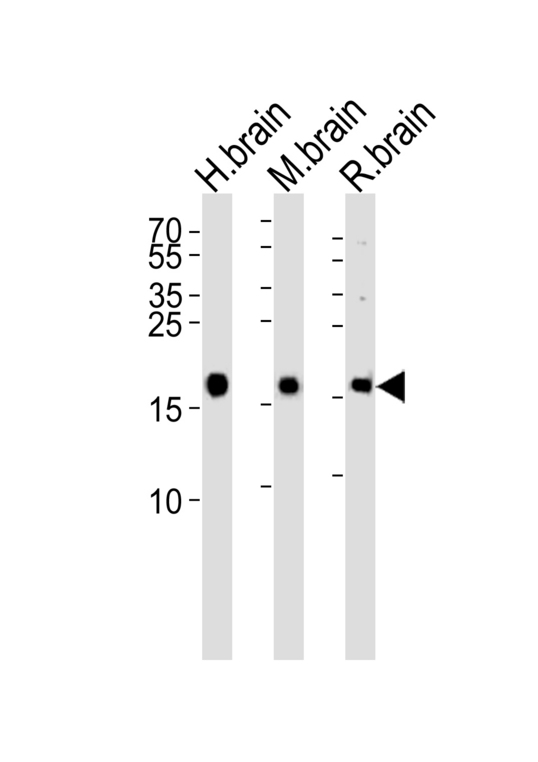 VILIP / VSNL1 Antibody - Western blot of lysates from human brain, mouse brain and rat brain tissue lysate (from left to right), using VILIP1 Antibody. Antibody was diluted at 1:1000 at each lane. A goat anti-rabbit IgG H&L (HRP) at 1:5000 dilution was used as the secondary antibody. Lysates at 35ug per lane.