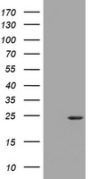 VILIP / VSNL1 Antibody - HEK293T cells were transfected with the pCMV6-ENTRY control (Left lane) or pCMV6-ENTRY ${SYMBOL} (${RC_SKU}, Right lane) cDNA for 48 hrs and lysed. Equivalent amounts of cell lysates (5 ug per lane) were separated by SDS-PAGE and immunoblotted with anti-${SYMBOL}.