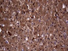 VILIP / VSNL1 Antibody - IHC of paraffin-embedded Human liver tissue using anti-VSNL1 mouse monoclonal antibody. (Heat-induced epitope retrieval by 10mM citric buffer, pH6.0, 120°C for 3min).