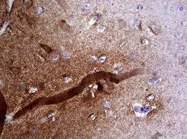 VILIP / VSNL1 Antibody - IHC of paraffin-embedded Human adult brain tissue using anti-VSNL1 mouse monoclonal antibody. (Heat-induced epitope retrieval by 10mM citric buffer, pH6.0, 120°C for 3min).