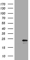 VILIP / VSNL1 Antibody - HEK293T cells were transfected with the pCMV6-ENTRY control (Left lane) or pCMV6-ENTRY VSNL1 (Right lane) cDNA for 48 hrs and lysed. Equivalent amounts of cell lysates (5 ug per lane) were separated by SDS-PAGE and immunoblotted with anti-VSNL1.