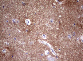 VILIP / VSNL1 Antibody - IHC of paraffin-embedded Human adult heart tissue using anti-VSNL1 mouse monoclonal antibody. (Heat-induced epitope retrieval by 10mM citric buffer, pH6.0, 120°C for 3min).