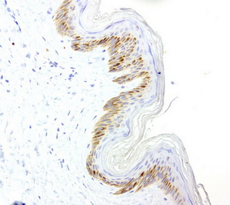 VILIP / VSNL1 Antibody - Immunohistochemical staining of paraffin-embedded human skin using anti-VSNL1 clone UMAB115 mouse monoclonal antibody  at 1:200 with Polink2 Broad HRP DAB detection kit; heat-induced epitope retrieval with GBI Citrate pH6.0 HIER buffer using pre