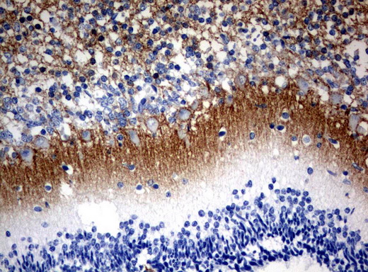 VILIP / VSNL1 Antibody - Immunohistochemical staining of paraffin-embedded Human embryonic cerebellum using anti-VSNL1 mouse monoclonal antibody.  heat-induced epitope retrieval by 10mM citric buffer, pH6.0, 120C for 3min)