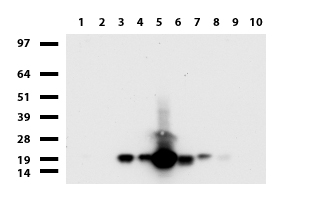 VILIP / VSNL1 Antibody - Western blot of human tissue lysates. (15ug) from 10 different tissues. (1: Testis, 2: Omentum, 3: Uterus, 4: Breast, 5: Brain, 6: Liver, 7: Ovary, 8: Colon, 9: Spleen, 10: Thyroid). Diluation: 1:500.