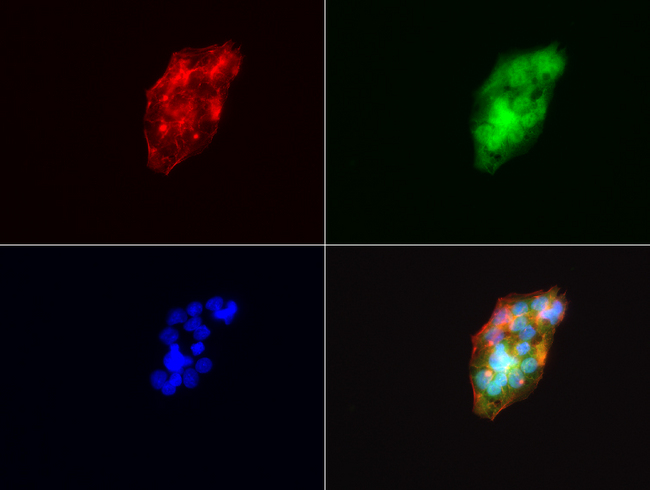 VILIP / VSNL1 Antibody - Immunofluorescent staining of HepG2 cells using anti-VSNL1 mouse monoclonal antibody  green, 1:100). Actin filaments were labeled with Alexa Fluor® 594 Phalloidin. (red), and nuclear with DAPI. (blue).