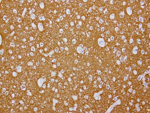 VILIP / VSNL1 Antibody - Immunohistochemical staining of paraffin-embedded human brain using anti-VSNL1 clone UMAB116 mouse monoclonal antibody  at 1:200 with Polink2 Broad HRP DAB detection kit; heat-induced epitope retrieval with GBI Citrate pH6.0 HIER buffer using pr