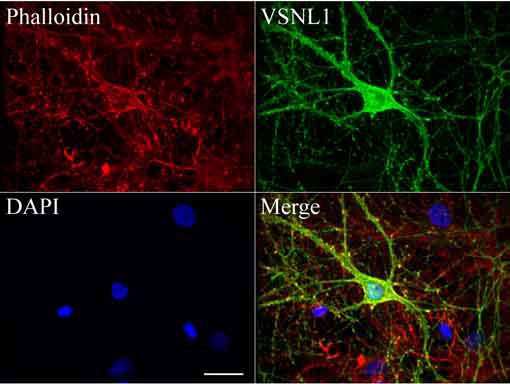 VILIP / VSNL1 Antibody - Confocal immunofluoresce image of primary rat neurons labeled with anti-VSNL1 mouse monoclonal antibody  green, 1:100). Actin filaments were labeled with TRICT-Phalloidin. (red), and nuclear with DAPI. (blue). Scale bar, 20µm.