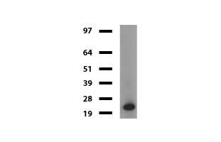 VILIP / VSNL1 Antibody - Western blot of mouse tissue lysates. (20ug) from Brian. Primary antibody diluation: 1:500. Secondary antibody dilution: Mouse TrueBlot® Ultra. (1:1000).