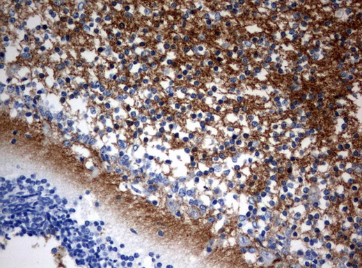 VILIP / VSNL1 Antibody - Immunohistochemical staining of paraffin-embedded Human embryonic cerebellum using anti-VSNL1 mouse monoclonal antibody.  heat-induced epitope retrieval by 10mM citric buffer, pH6.0, 120C for 3min)