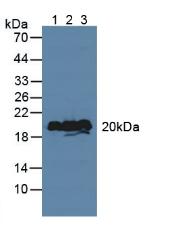 VILIP / VSNL1 Antibody - Western Blot; Sample: Lane1: Porcine Brain Tissue; Lane2: Mouse Brain Tissue; Lane3: Rat Brain Tissue.