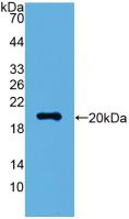 VILIP / VSNL1 Antibody - Western Blot; Sample: Recombinant VSNL1, Human.