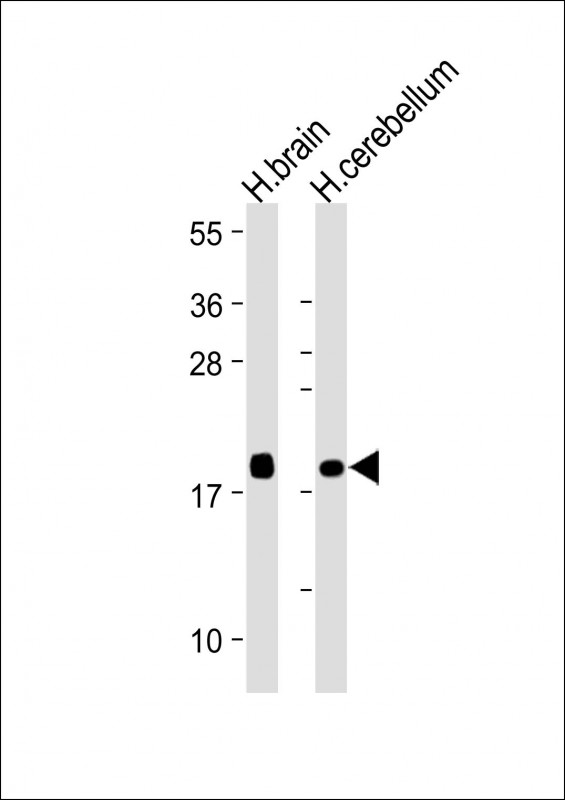 VILIP / VSNL1 Antibody - All lanes: Anti-VILIP1 Antibody at 1:4000 dilution Lane 1: Human brain lysate Lane 2: Human cerebellum lysate Lysates/proteins at 20 µg per lane. Secondary Goat Anti-mouse IgG, (H+L), Peroxidase conjugated at 1/10000 dilution. Predicted band size: 22 kDa Blocking/Dilution buffer: 5% NFDM/TBST.