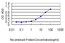 VILIP / VSNL1 Antibody - Detection limit for recombinant GST tagged VSNL1 is approximately 0.3 ng/ml as a capture antibody.