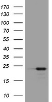 VILIP / VSNL1 Antibody - HEK293T cells were transfected with the pCMV6-ENTRY control (Left lane) or pCMV6-ENTRY VSNL1 (Right lane) cDNA for 48 hrs and lysed. Equivalent amounts of cell lysates (5 ug per lane) were separated by SDS-PAGE and immunoblotted with anti-VSNL1.