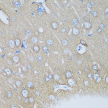 VILIP / VSNL1 Antibody - Immunohistochemistry of paraffin-embedded mouse brain tissue.