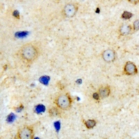 VILIP / VSNL1 Antibody - Immunohistochemical analysis of VILIP-1 staining in mouse brain formalin fixed paraffin embedded tissue section. The section was pre-treated using heat mediated antigen retrieval with sodium citrate buffer (pH 6.0). The section was then incubated with the antibody at room temperature and detected using an HRP conjugated compact polymer system. DAB was used as the chromogen. The section was then counterstained with hematoxylin and mounted with DPX.
