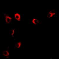 VILIP / VSNL1 Antibody - Immunofluorescent analysis of VILIP-1 staining in U2OS cells. Formalin-fixed cells were permeabilized with 0.1% Triton X-100 in TBS for 5-10 minutes and blocked with 3% BSA-PBS for 30 minutes at room temperature. Cells were probed with the primary antibody in 3% BSA-PBS and incubated overnight at 4 deg C in a humidified chamber. Cells were washed with PBST and incubated with a DyLight 594-conjugated secondary antibody (red) in PBS at room temperature in the dark.
