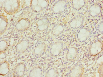 VILIP / VSNL1 Antibody - Immunohistochemistry of paraffin-embedded human rectum tissue at dilution 1:100