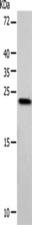 VILIP / VSNL1 Antibody - Western blot analysis of Hela cells  using VSNL1 Polyclonal Antibody at dilution of 1:900