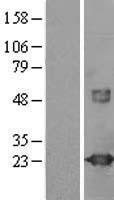 VILIP / VSNL1 Protein - Western validation with an anti-DDK antibody * L: Control HEK293 lysate R: Over-expression lysate
