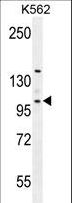 Villin-Like / VILL Antibody - VILL Antibody western blot of K562 cell line lysates (35 ug/lane). The VILL antibody detected the VILL protein (arrow).