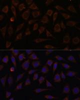 Villin-Like / VILL Antibody - Immunofluorescence analysis of L929 cells using VILL Polyclonal Antibody at dilution of 1:100.Blue: DAPI for nuclear staining.