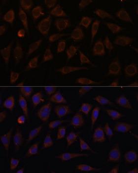 Villin-Like / VILL Antibody - Immunofluorescence analysis of L929 cells using VILL Polyclonal Antibody at dilution of 1:100.Blue: DAPI for nuclear staining.