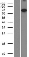Villin-Like / VILL Protein - Western validation with an anti-DDK antibody * L: Control HEK293 lysate R: Over-expression lysate