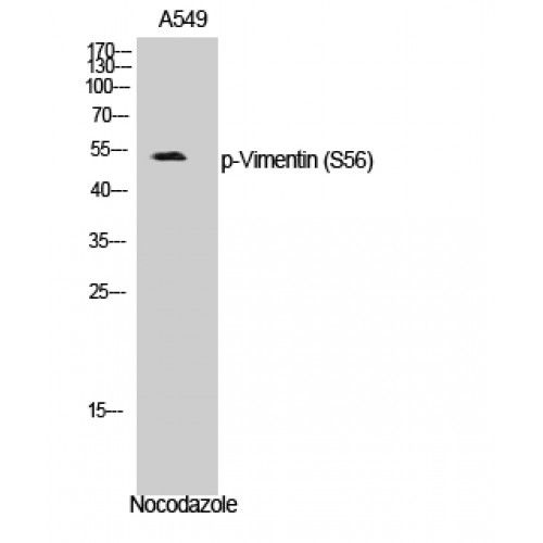 Vimentin Antibody - Western blot of Phospho-Vimentin (S56) antibody