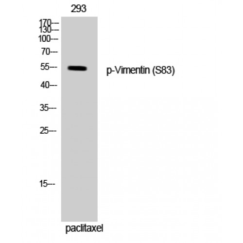 Vimentin Antibody - Western blot of Phospho-Vimentin (S83) antibody