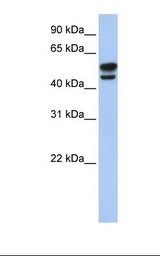 Vimentin Antibody - Fetal brain lysate. Antibody concentration: 1.0 ug/ml. Gel concentration: 12%.  This image was taken for the unconjugated form of this product. Other forms have not been tested.