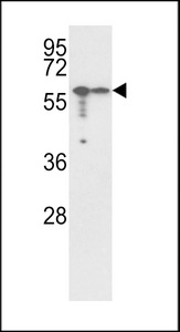Vimentin Antibody - Western blot of Vimentin Antibody in A2058,A375 cell line lysates (35 ug/lane). Vimentin (arrow) was detected using the purified antibody.
